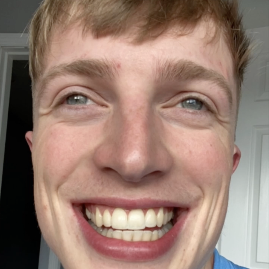 6 month braces - after - 3dental - Sean Fitz